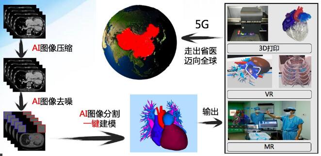 中国完成首例AI+5G心脏手术